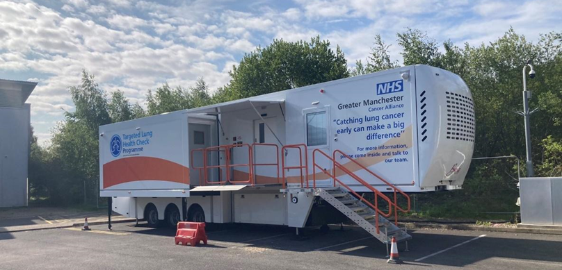 Research paper demonstrates significant reduction in late stage lung cancer thanks to community based screening programme